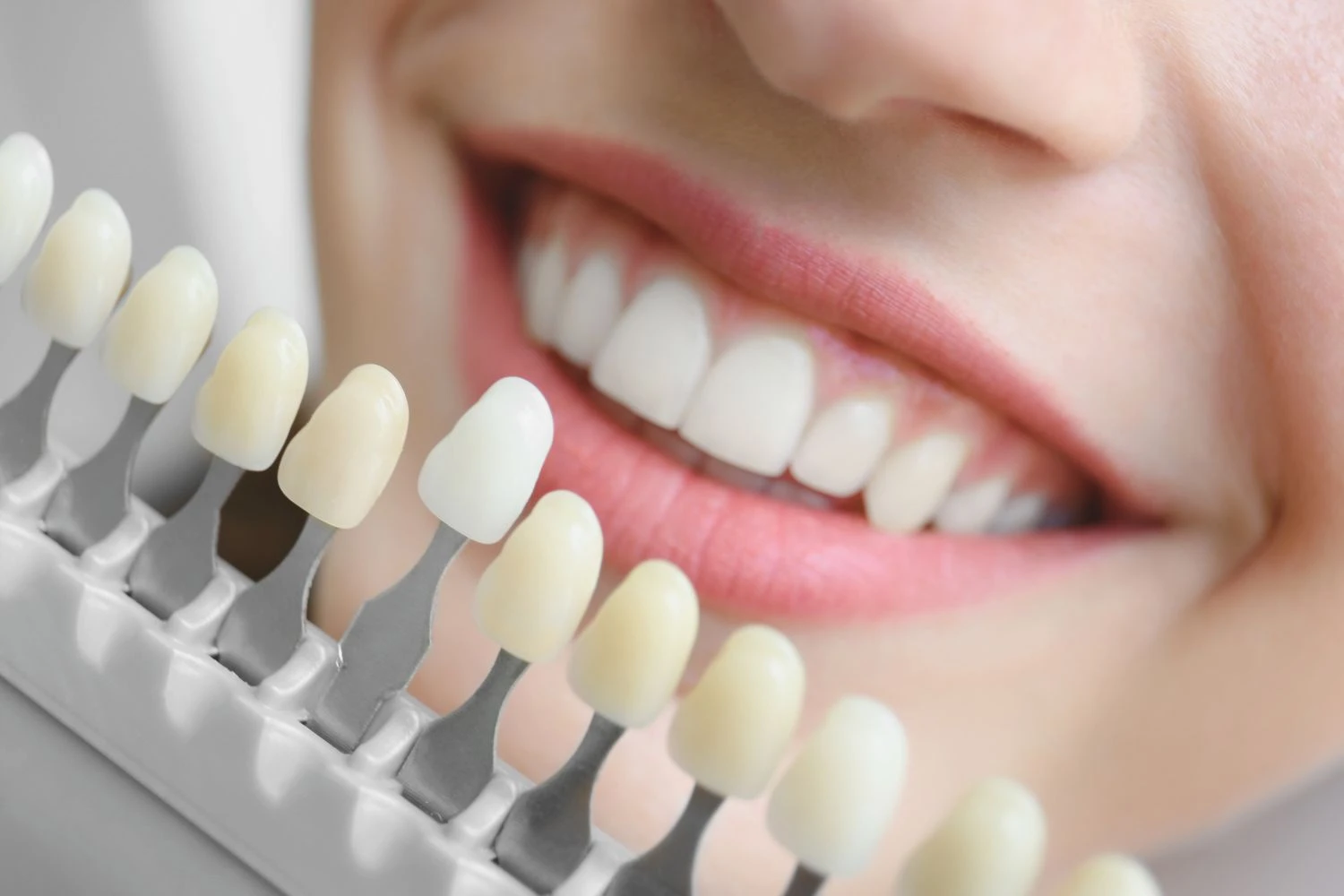 spa-4 Palma Dental