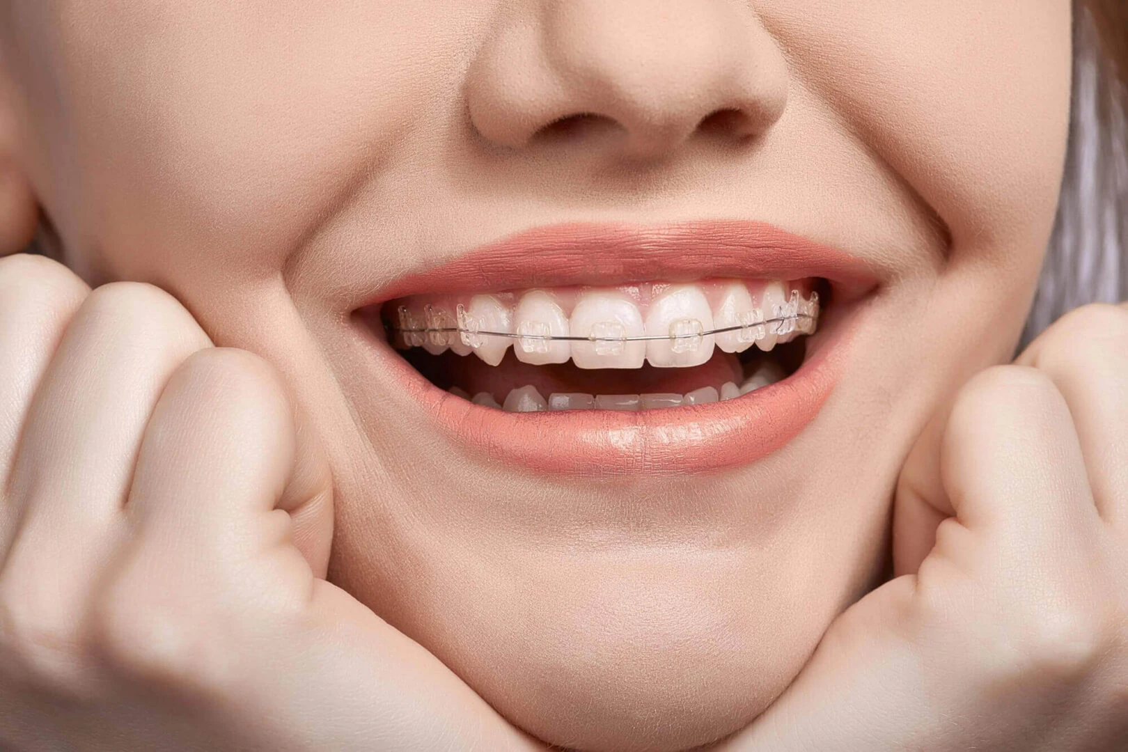 spa-3 Palma Dental